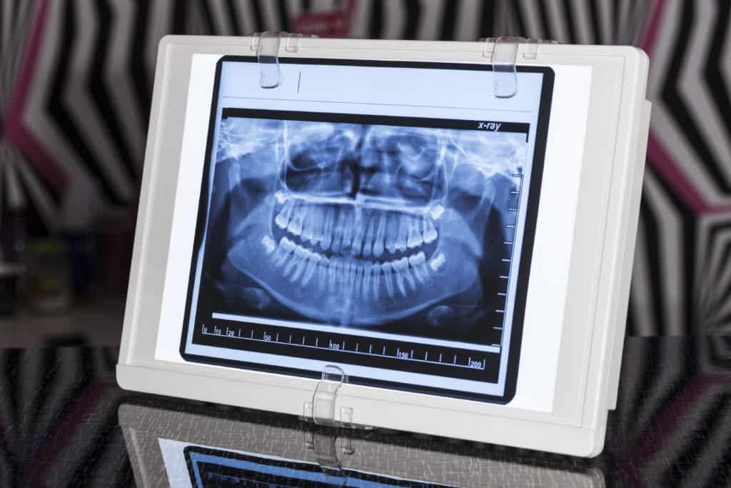 Panoramic Xray Viewer